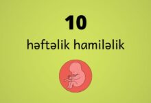 10 heftelik hamilelik