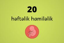 20 heftelik hamilelik