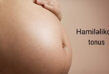 Hamilelikde tonus