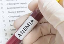 Qan azliginin elametleri